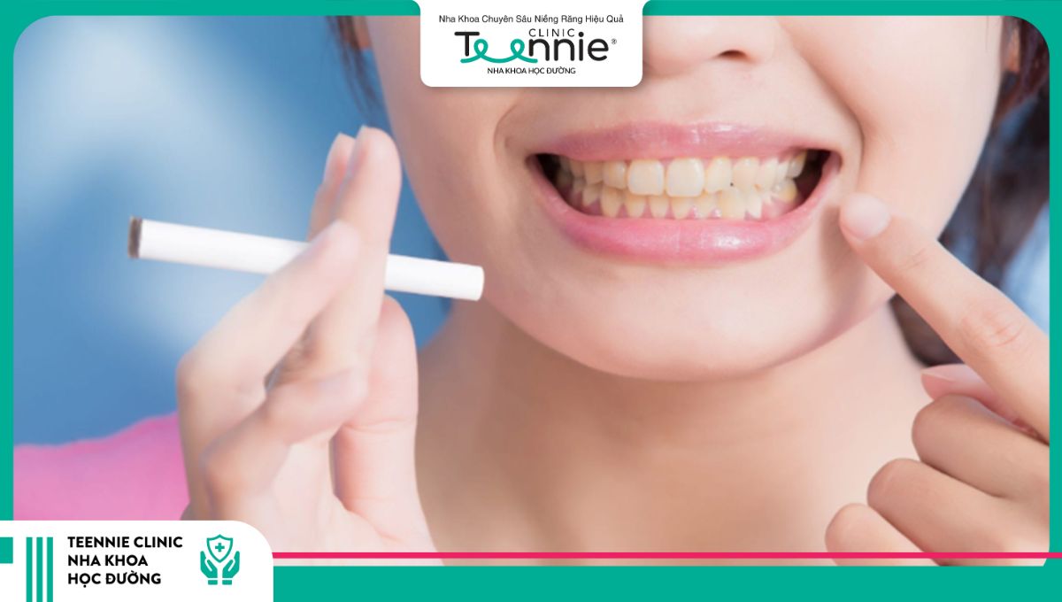 Thói quen hút thuốc lá gây ra tình trạng tam giác đen ở răng 