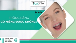 Trồng răng có niềng được không?