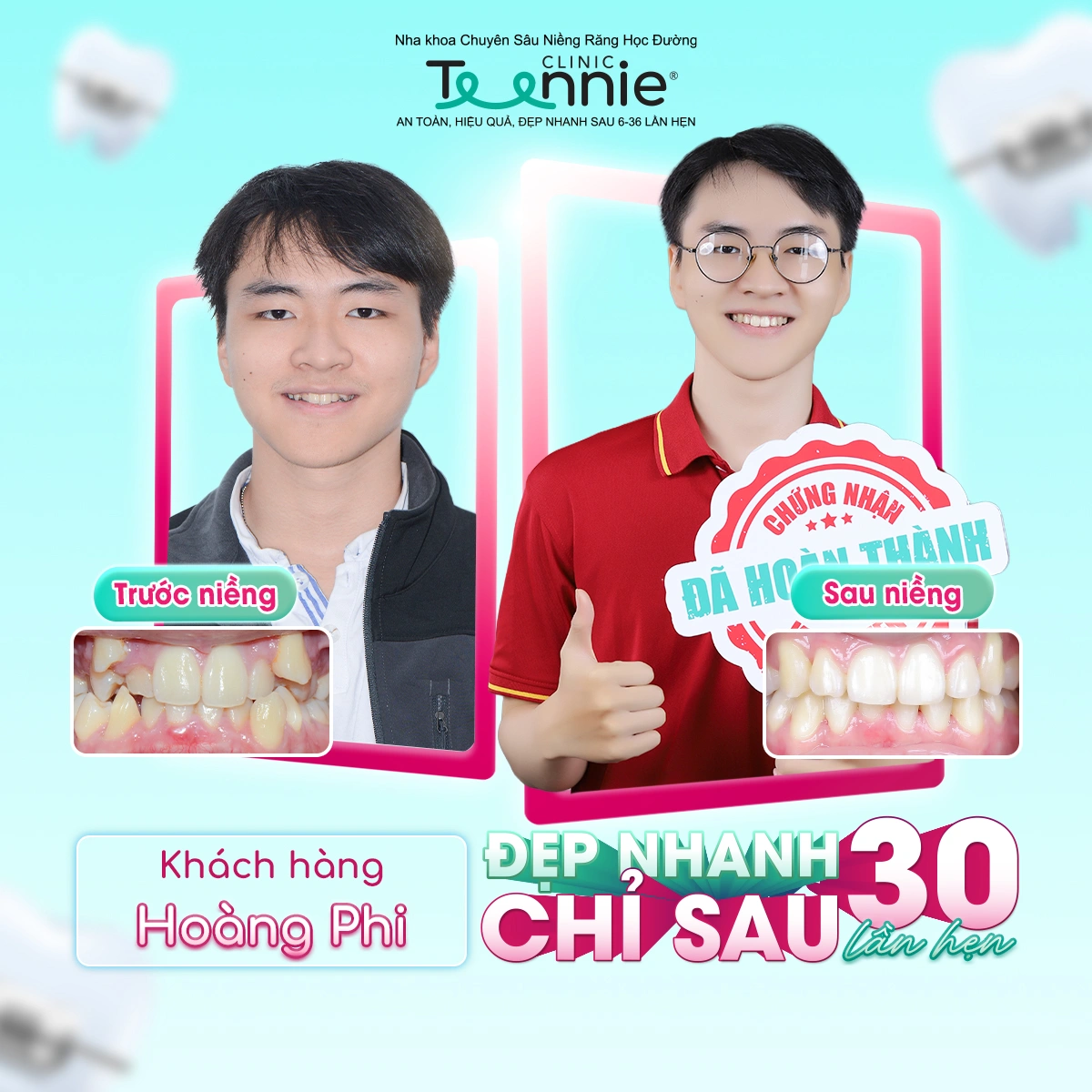 teennie-07-25-ldp-04