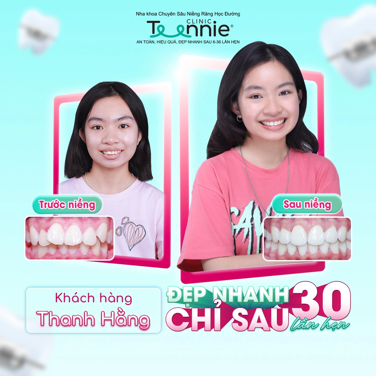 teennie-07-25-ldp-08