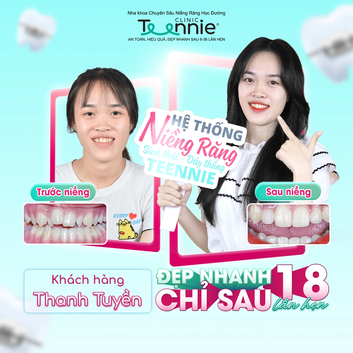 teennie-07-25-ldp-09