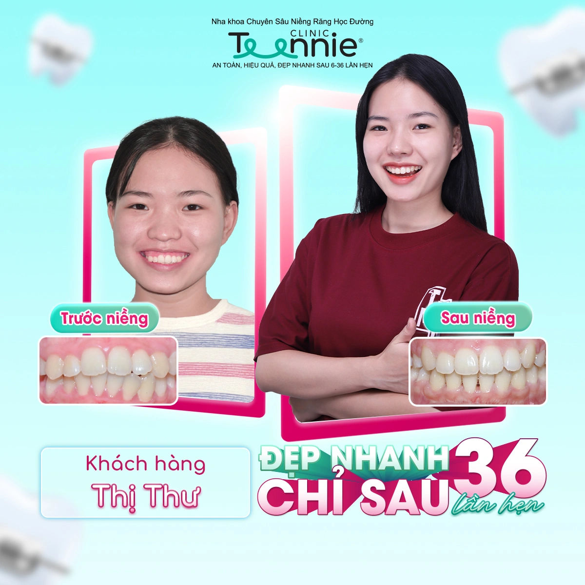 teennie-07-25-ldp-10