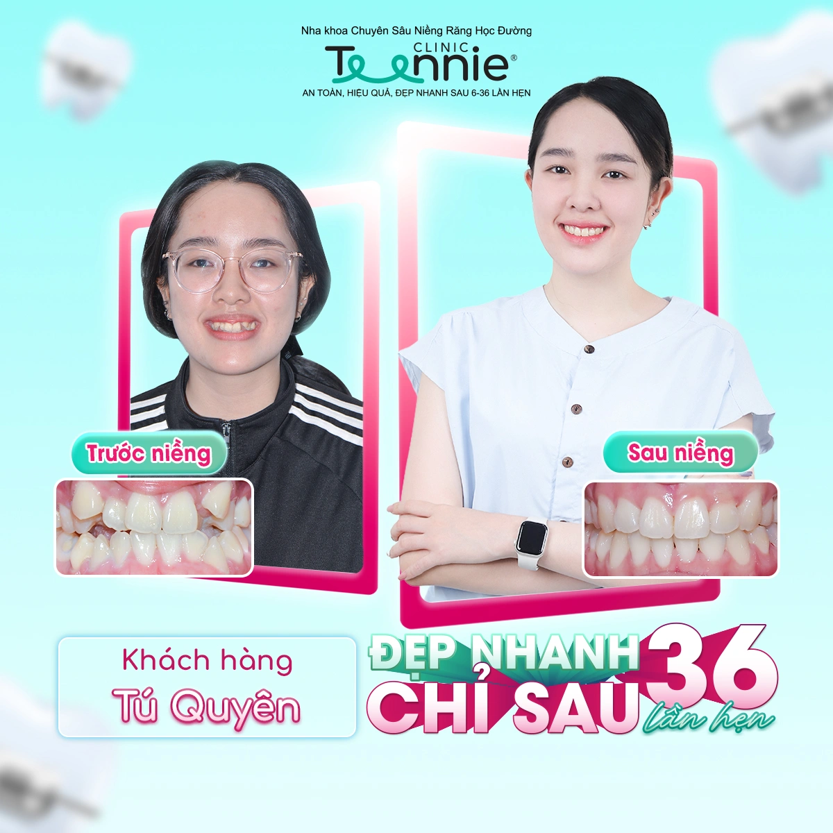 teennie-07-25-ldp-12