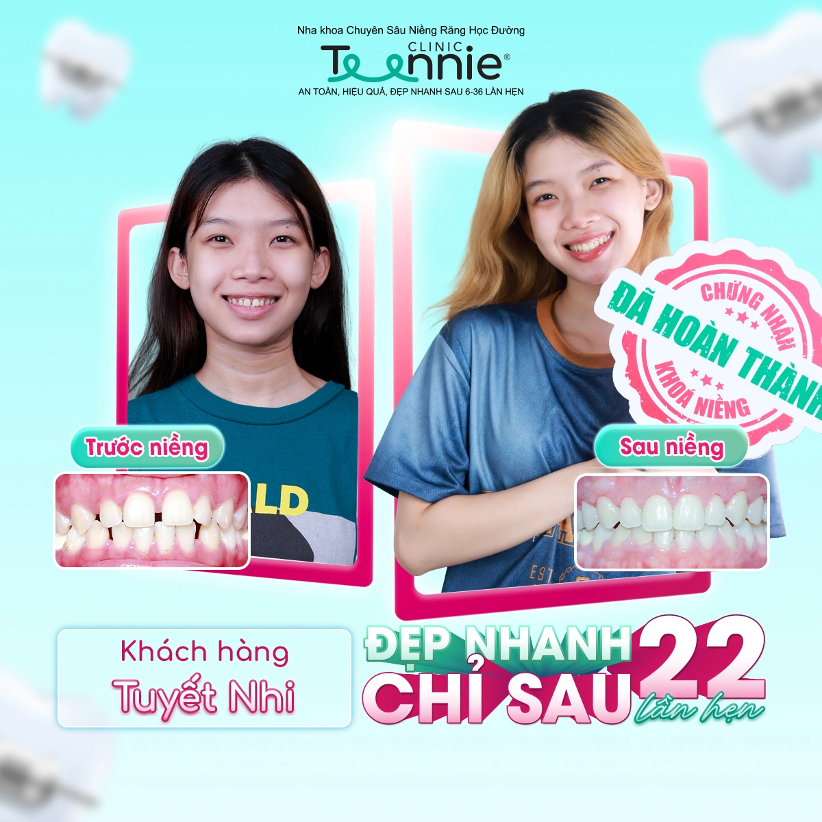teennie-07-25-ldp-13