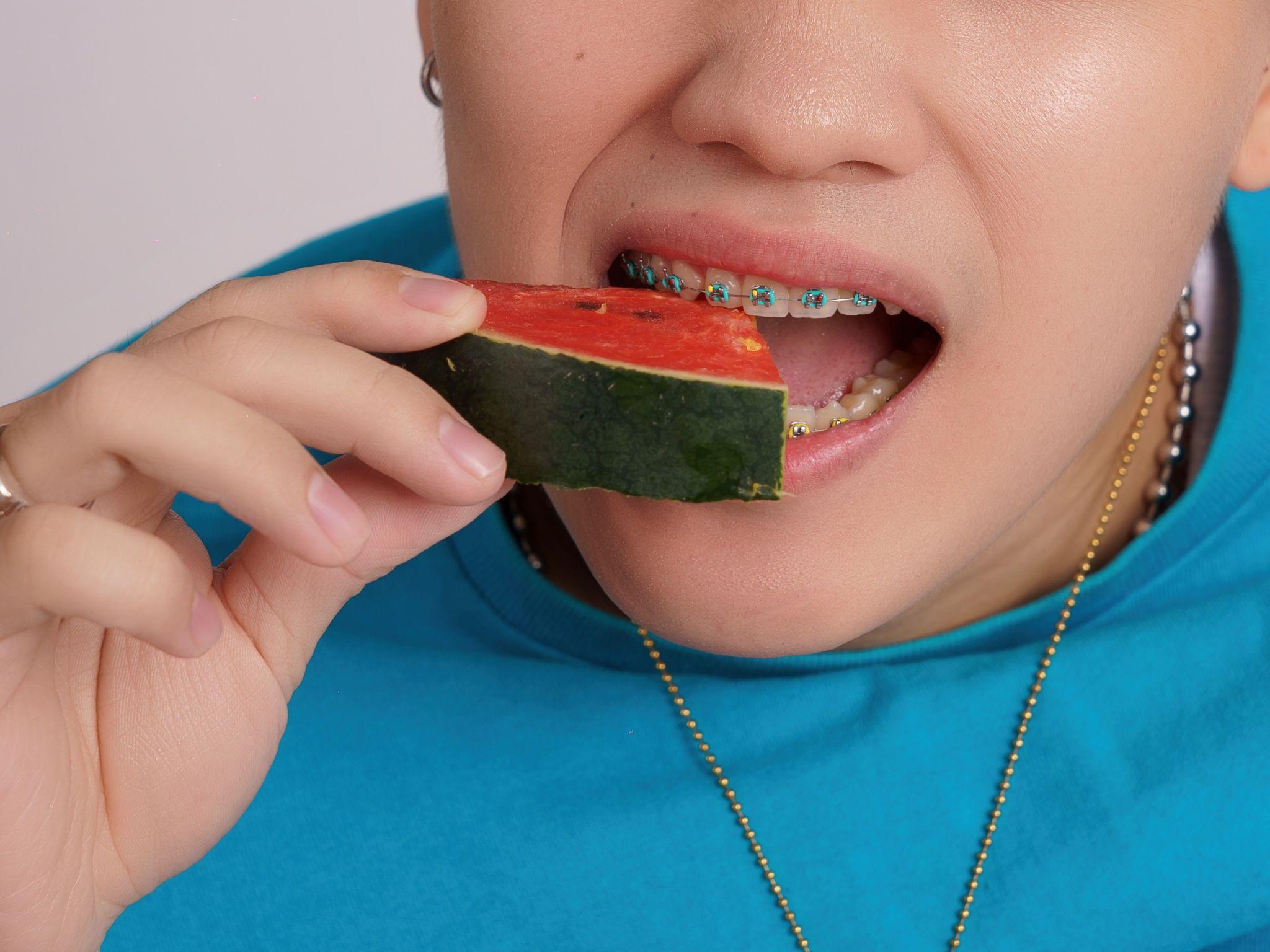 ăn gì khi niềng - hình 5