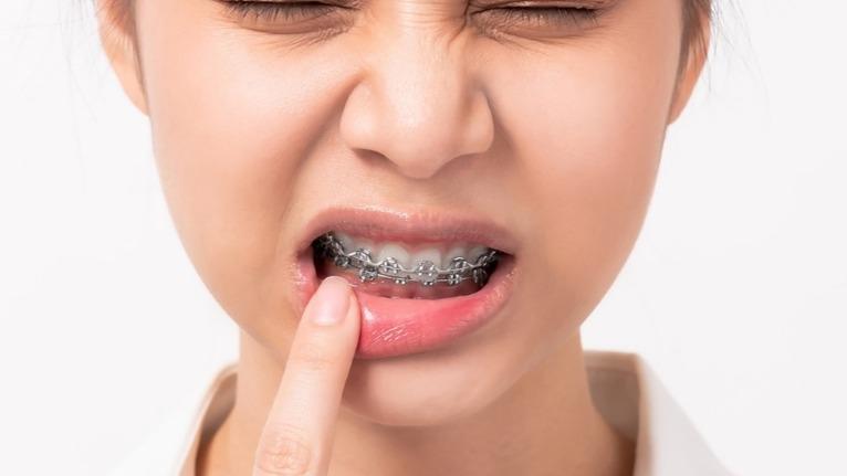 bang gia nieng rang 2026 tai teennie cap nhat moi nhat theo tung phuong phap 5