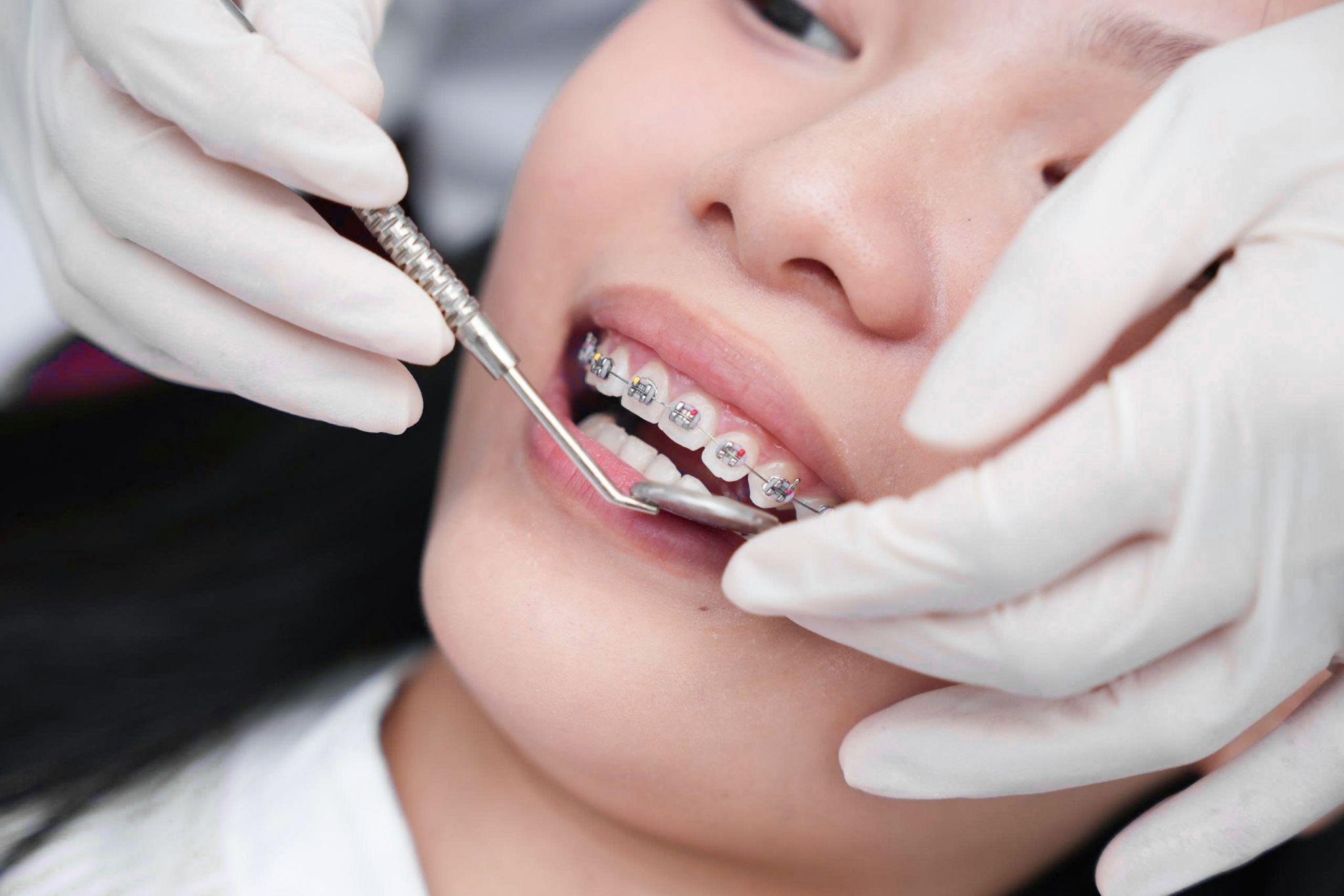 mac cai kinh dien day thun 1