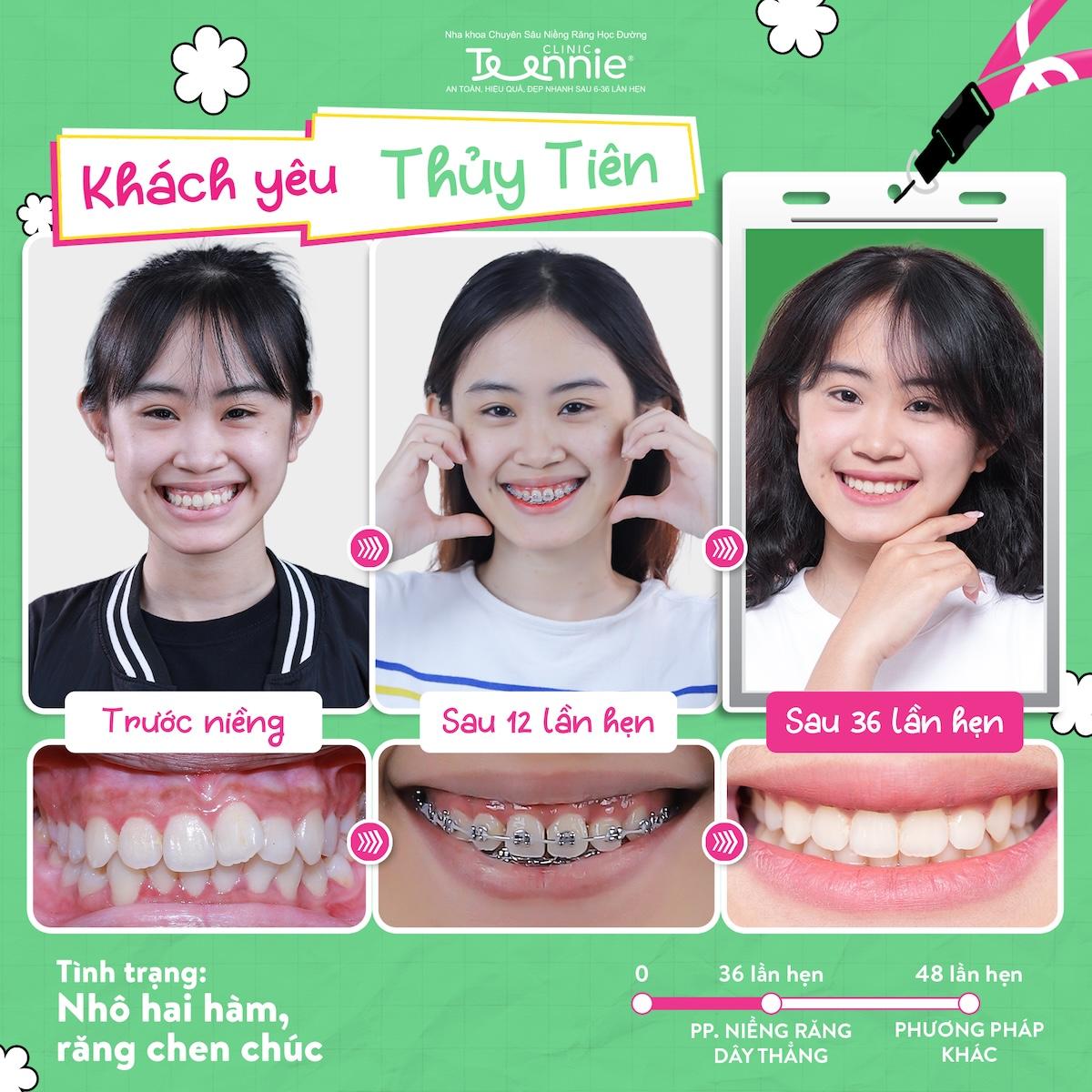 mac cai kinh dien day thun 2