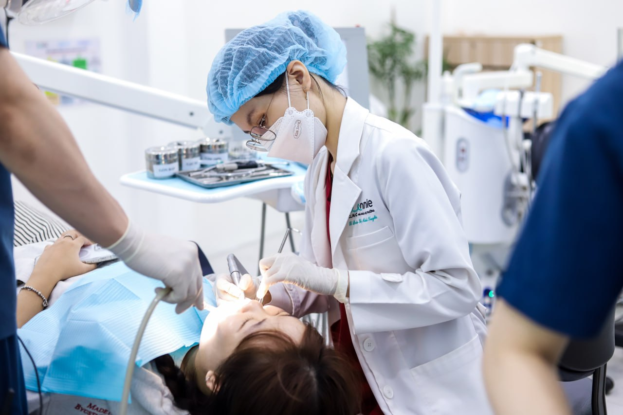 niềng răng mất bao lâu - hình 4