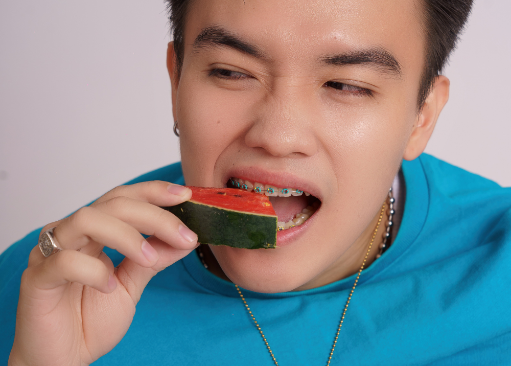 niềng răng tphcm - hình 6