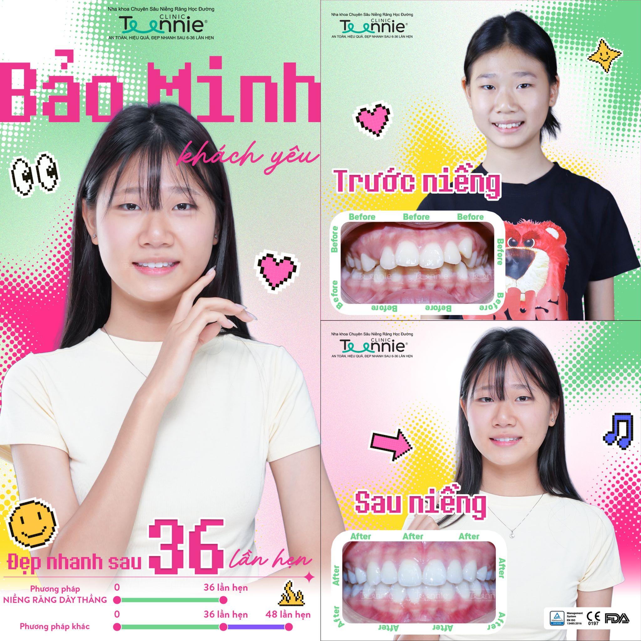 mắc cài kim loại tphcm - hình 2