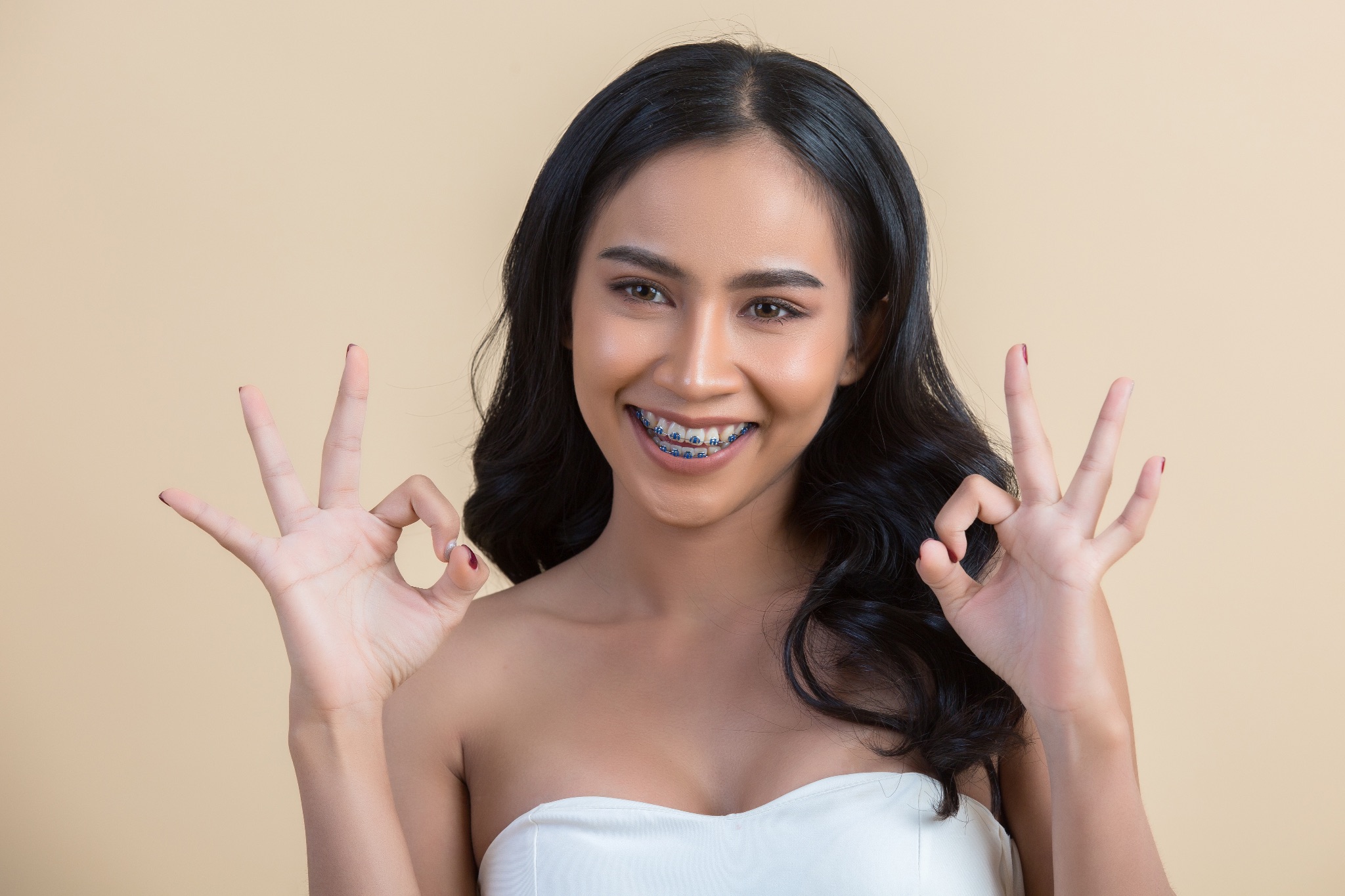 niềng răng khấp khểnh - hình 8