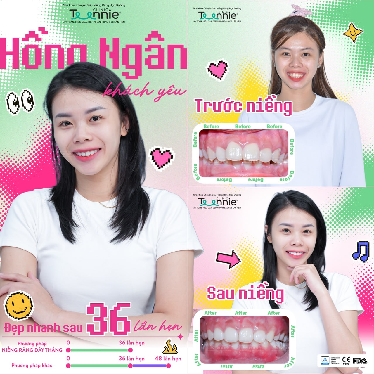niềng răng sinh viên tphcm - hình 3