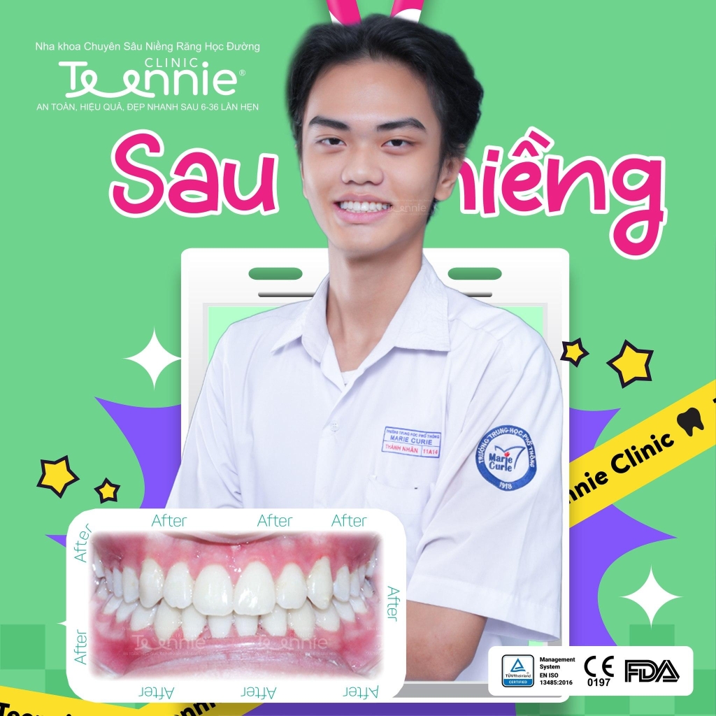 nieng rang mat bao lau 4