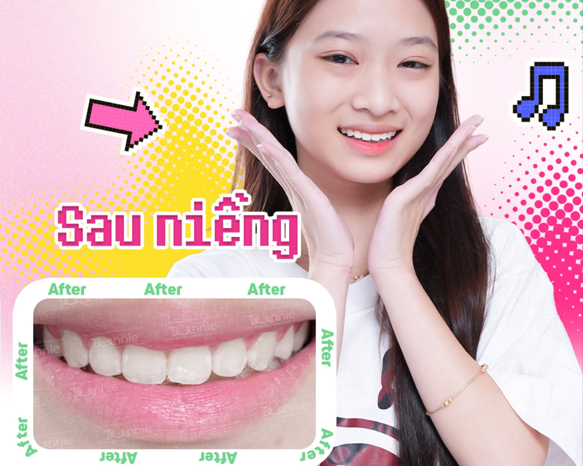 nieng rang tra gop 1