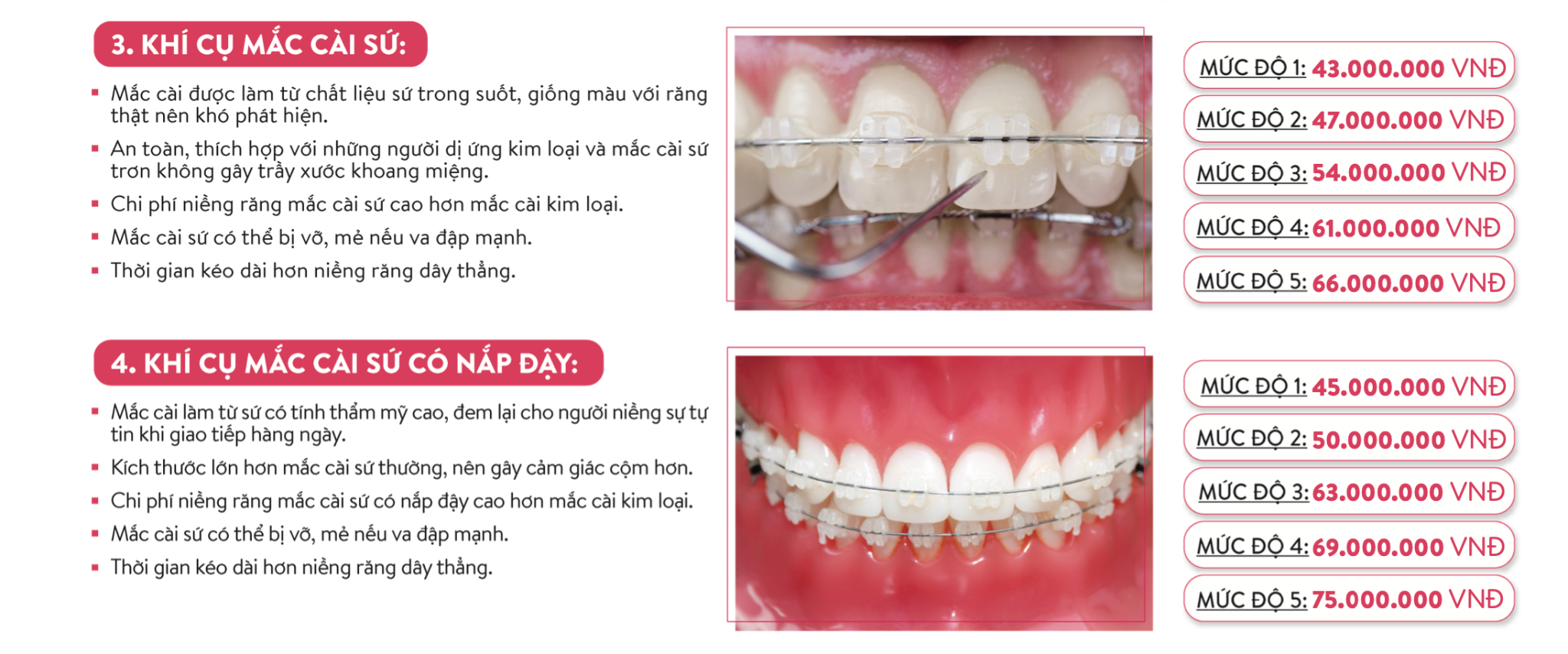 niềng răng học sinh tphcm - hình 4