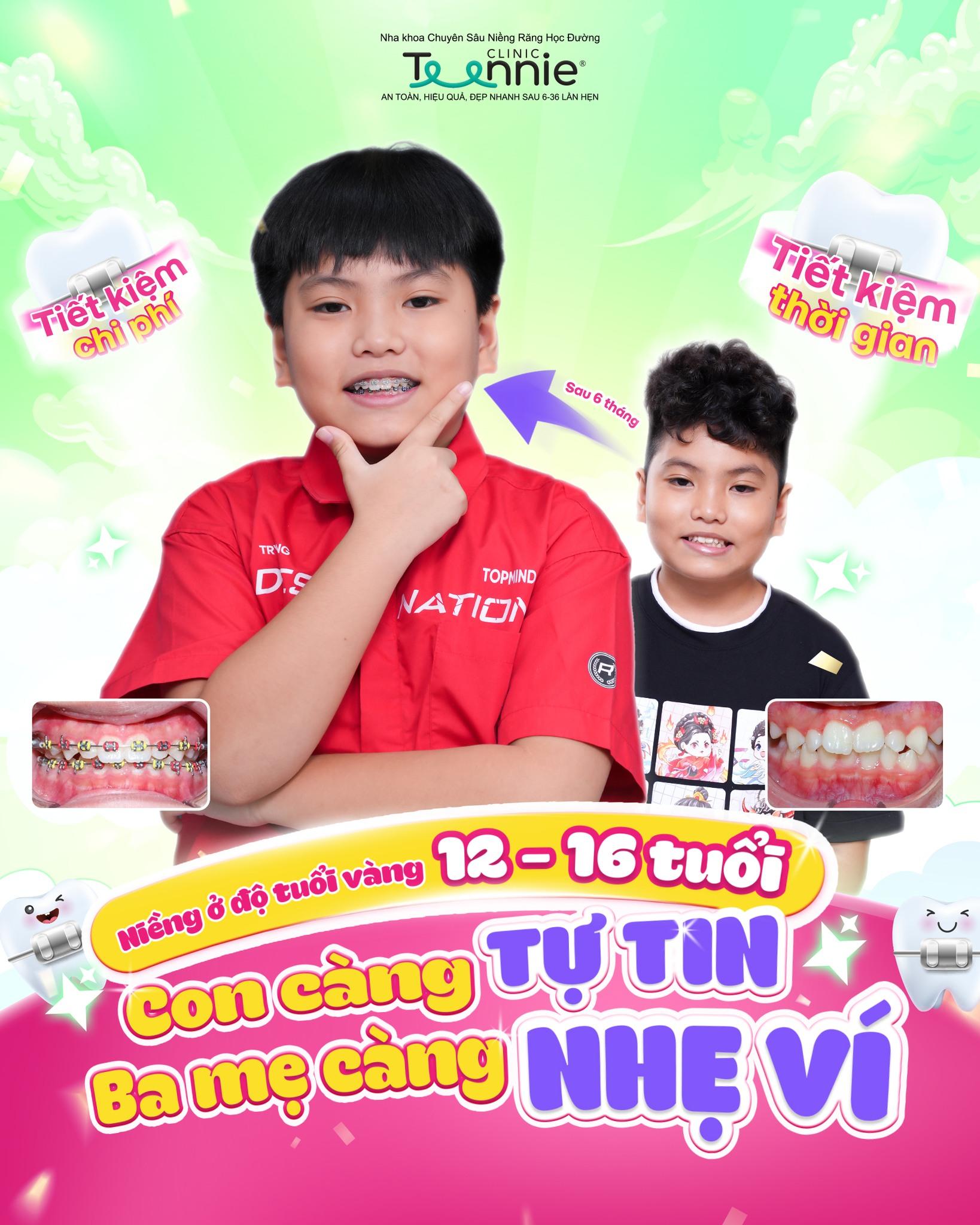 niềng răng học sinh tphcm - hình 6