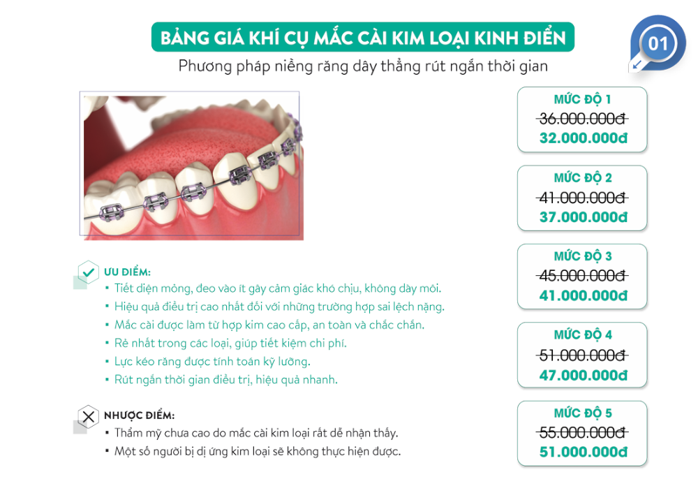 niềng răng cười hở lợi - hình 4
