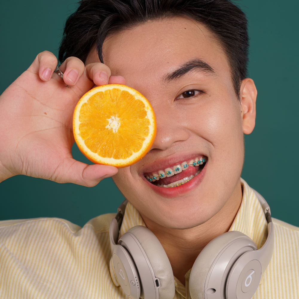 niềng răng giọng nói