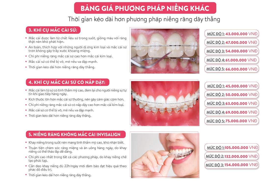 niềng răng học sinh - hình 4