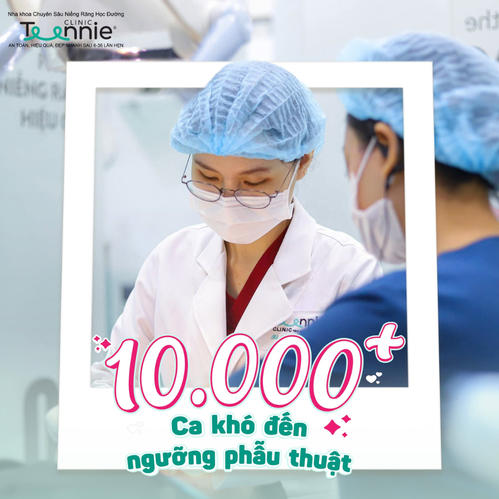 niềng răng làm má hóp - hình 4