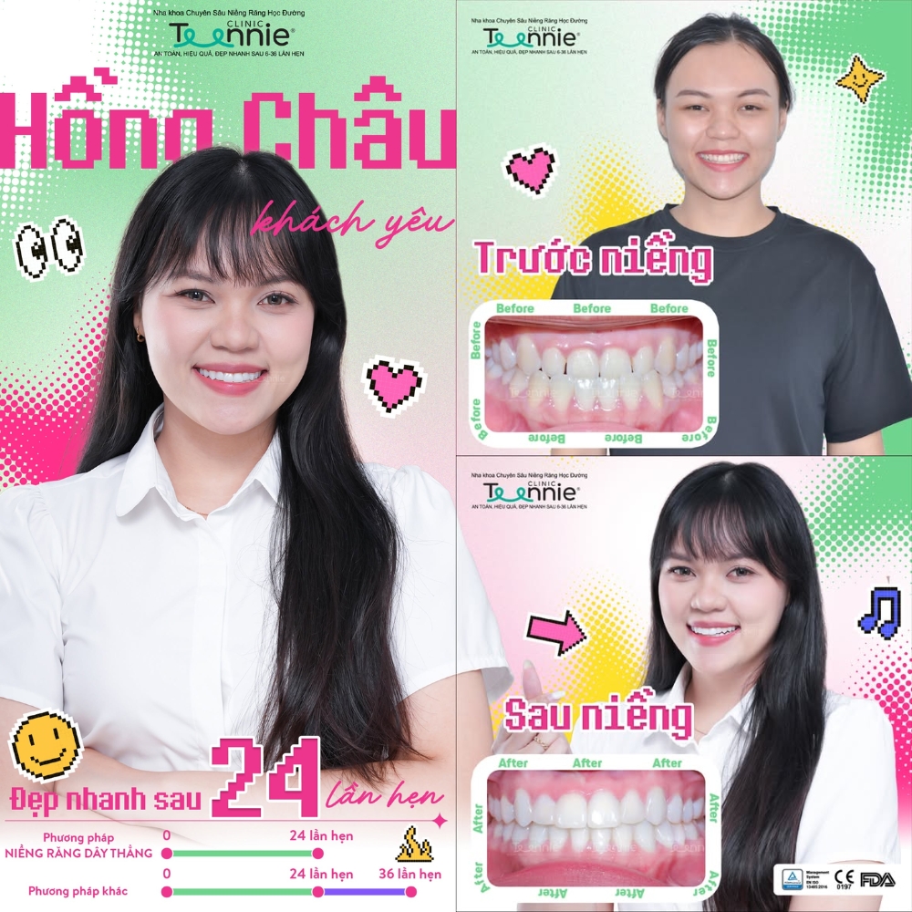 niềng răng yếu răng