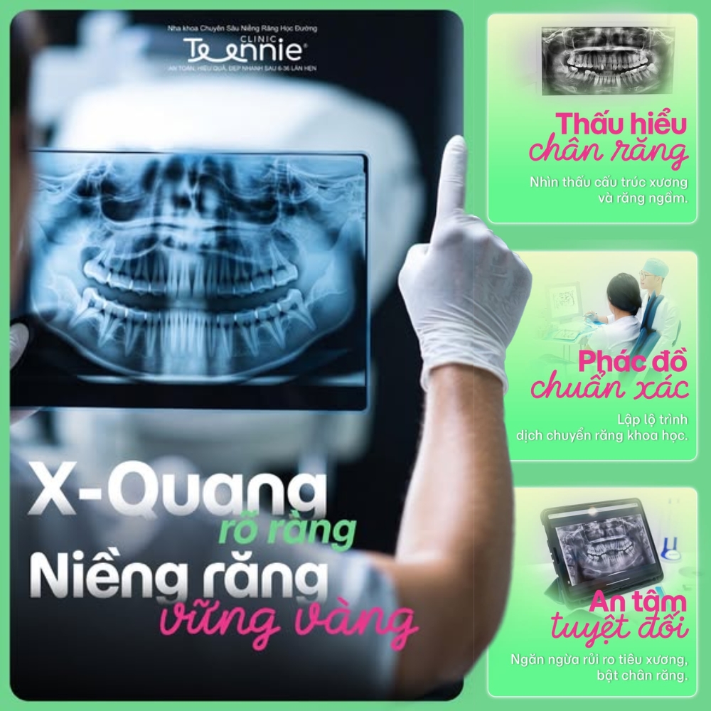 niềng răng yếu răng - hình 2