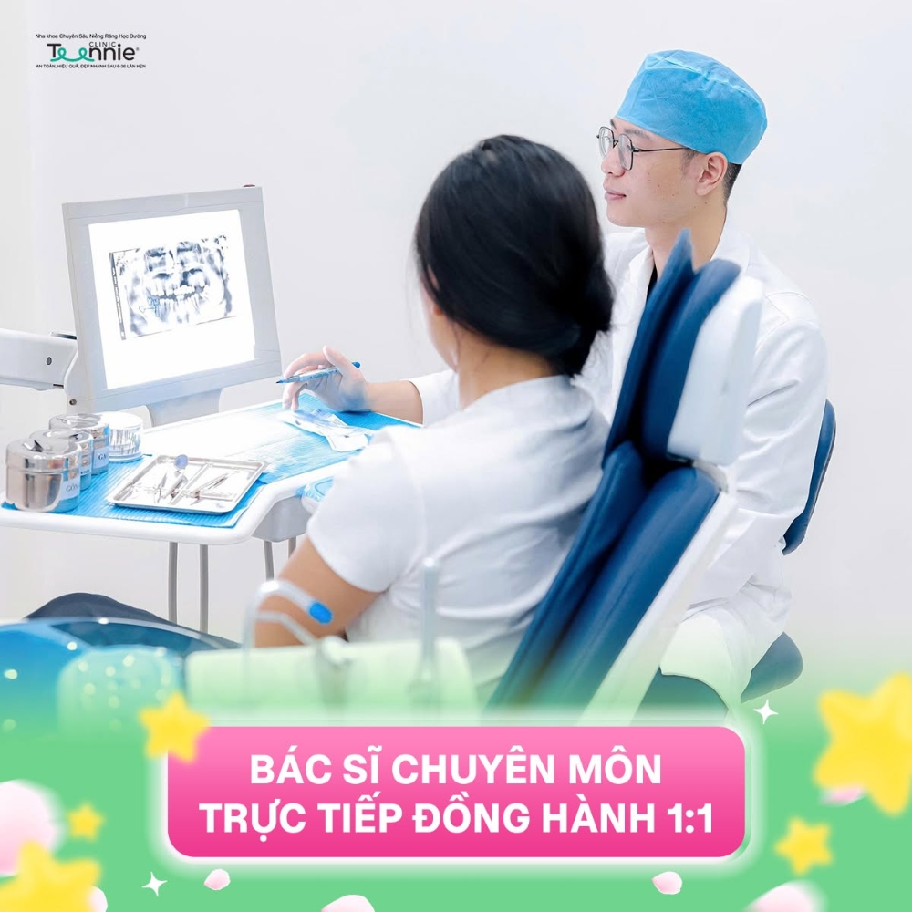 niềng tự buộc kinh điển - hình 4