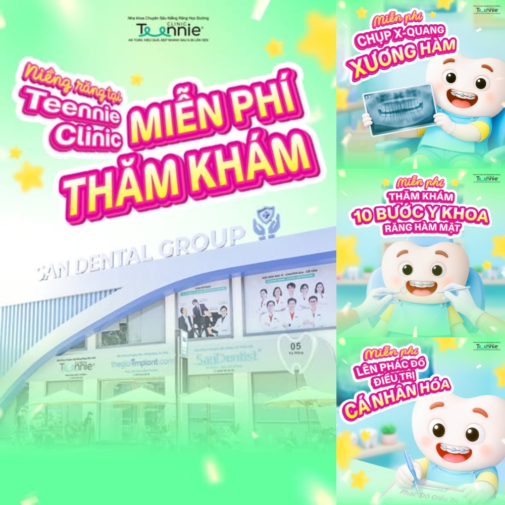 có nên niềng răng không - hình 3