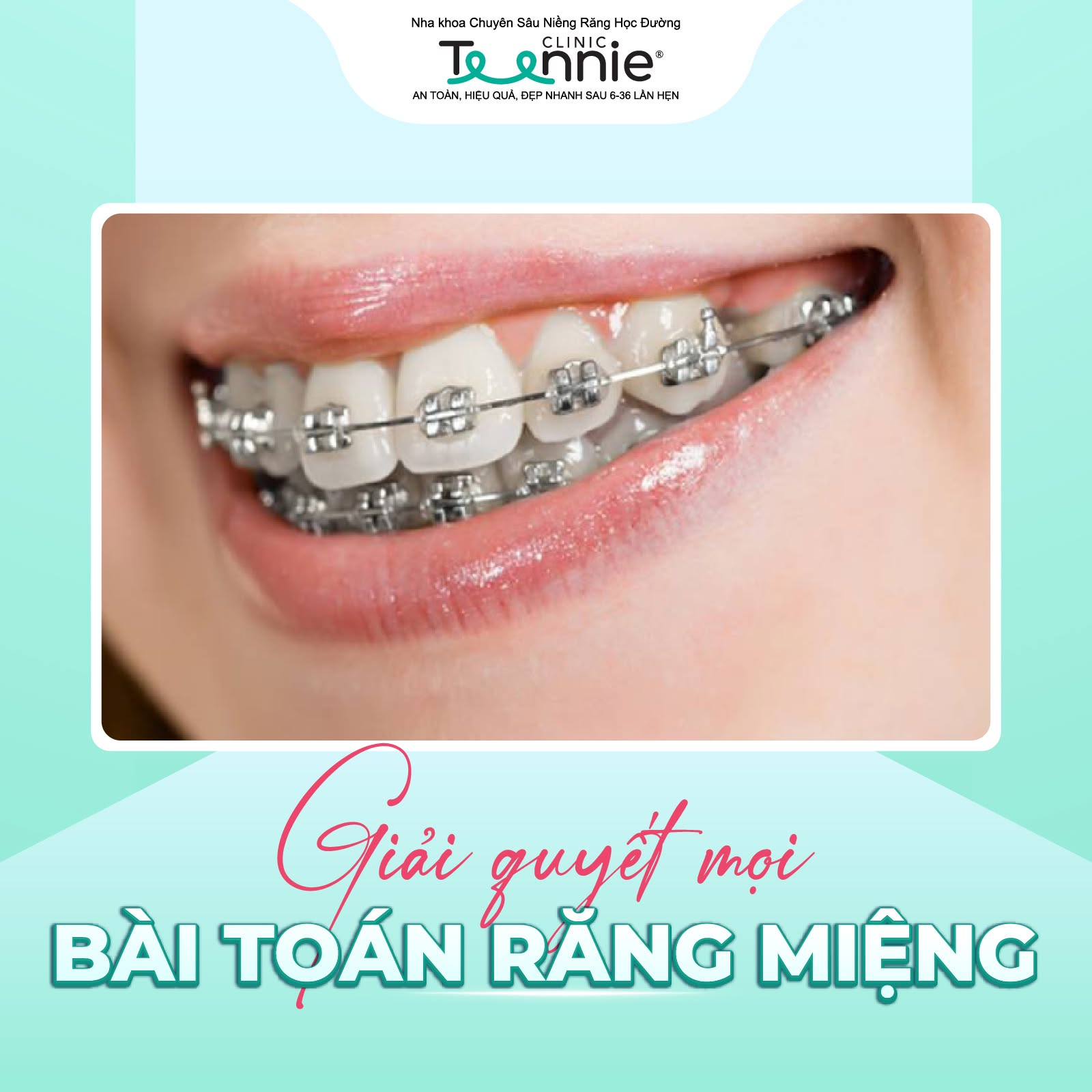 nieng rang cap 1 3