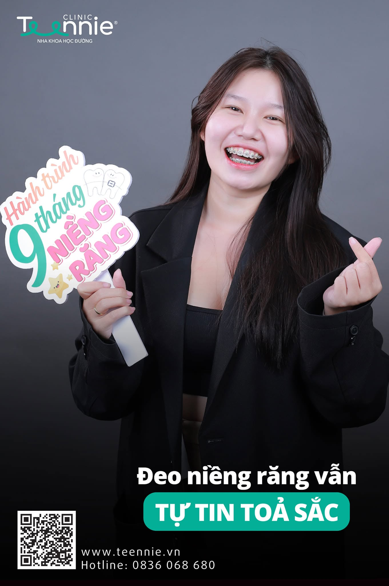 niềng răng tại nhà - hình 6