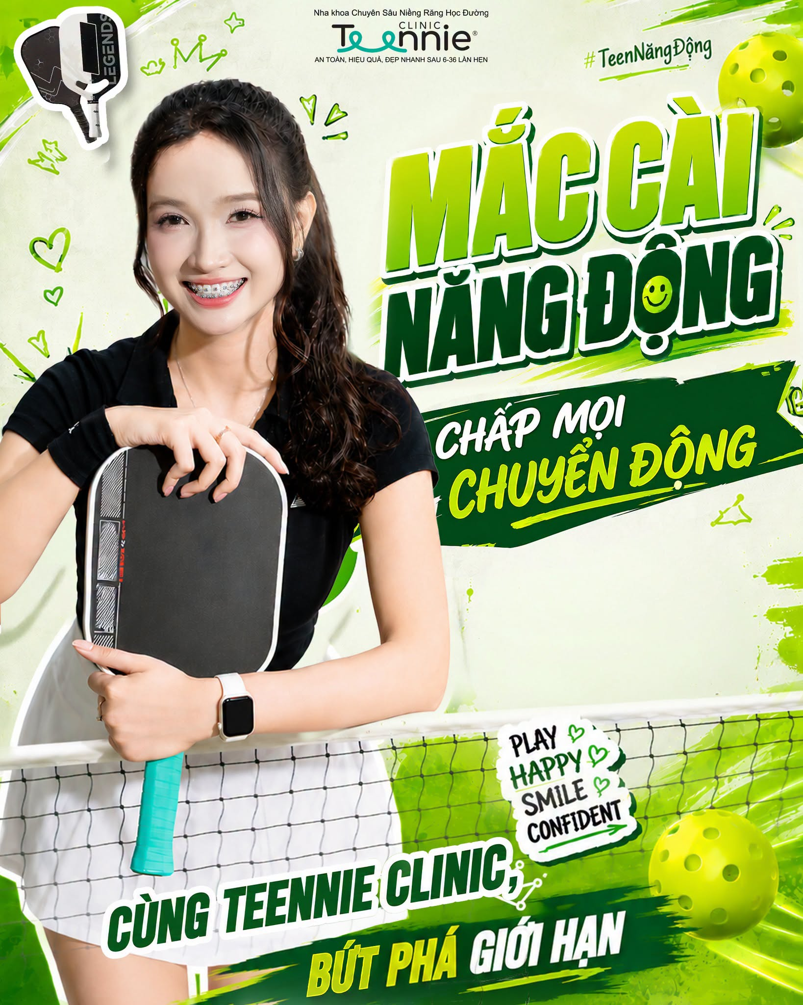 mắc cài kinh điển - hình 4