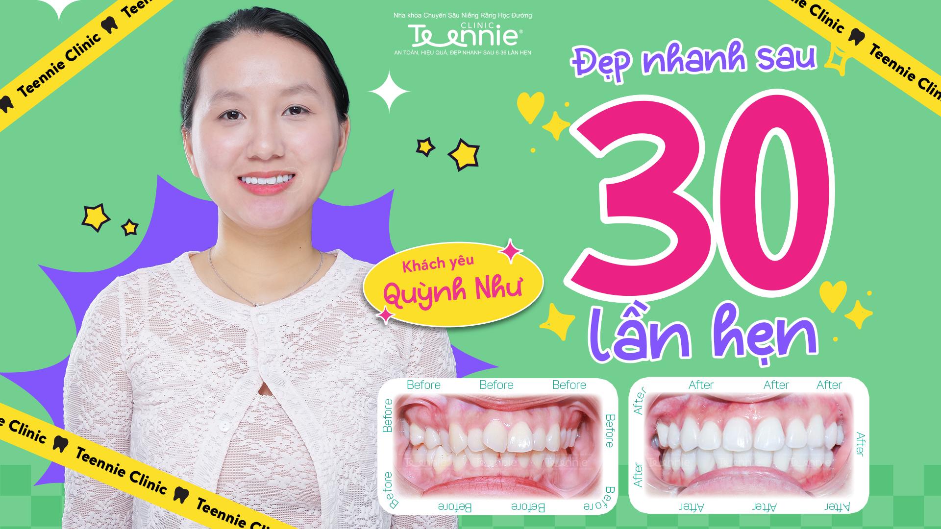 nieng rang lan 2 1