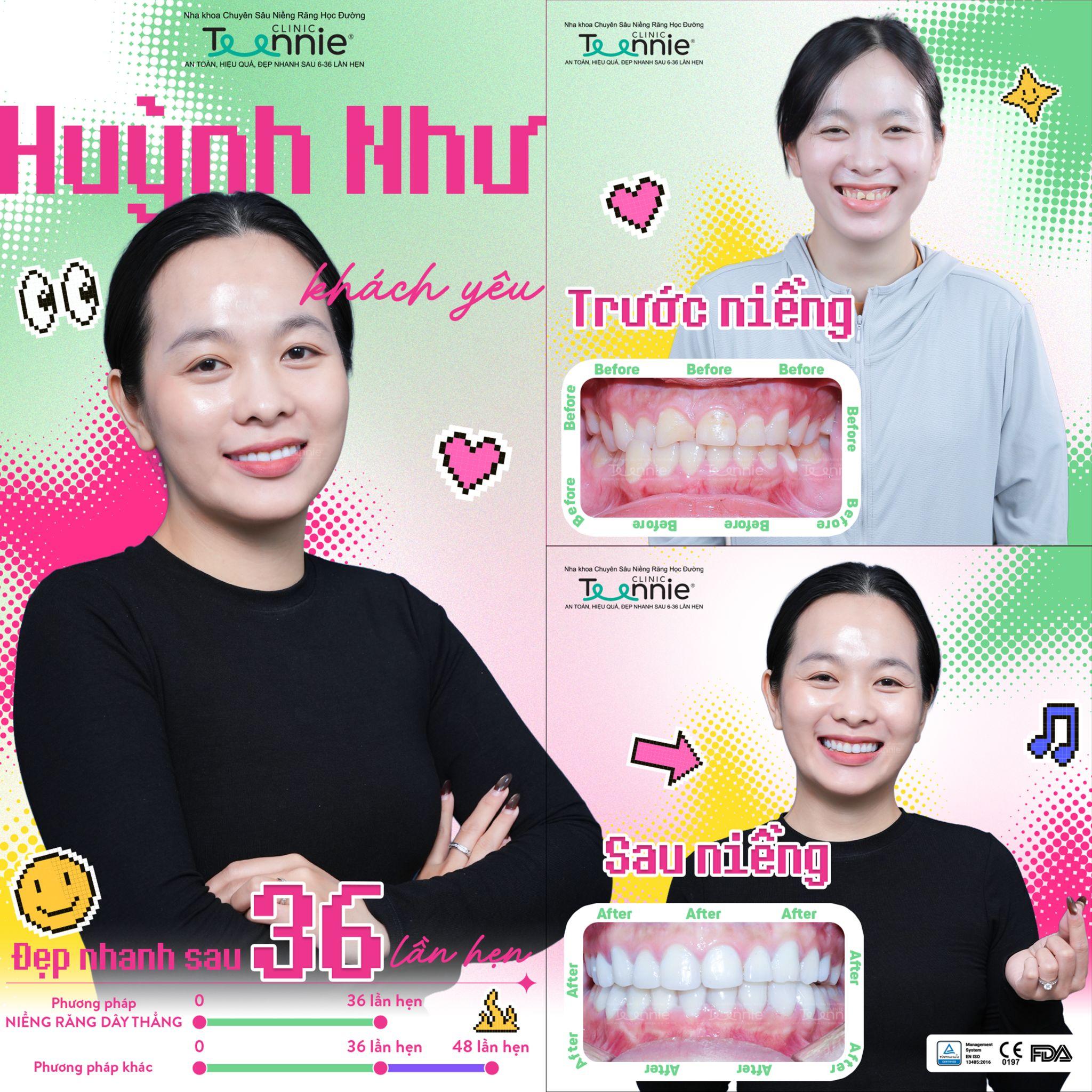 nieng rang sau chan thuong 1