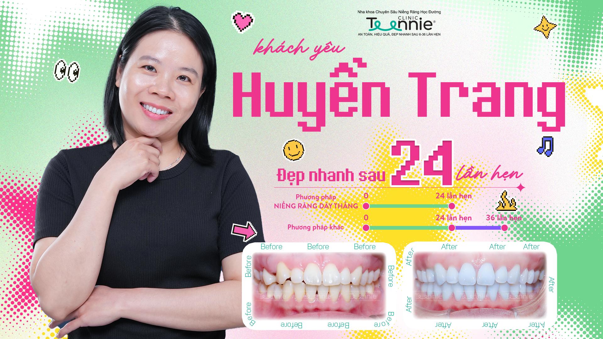 niềng răng và sinh con - hình 5