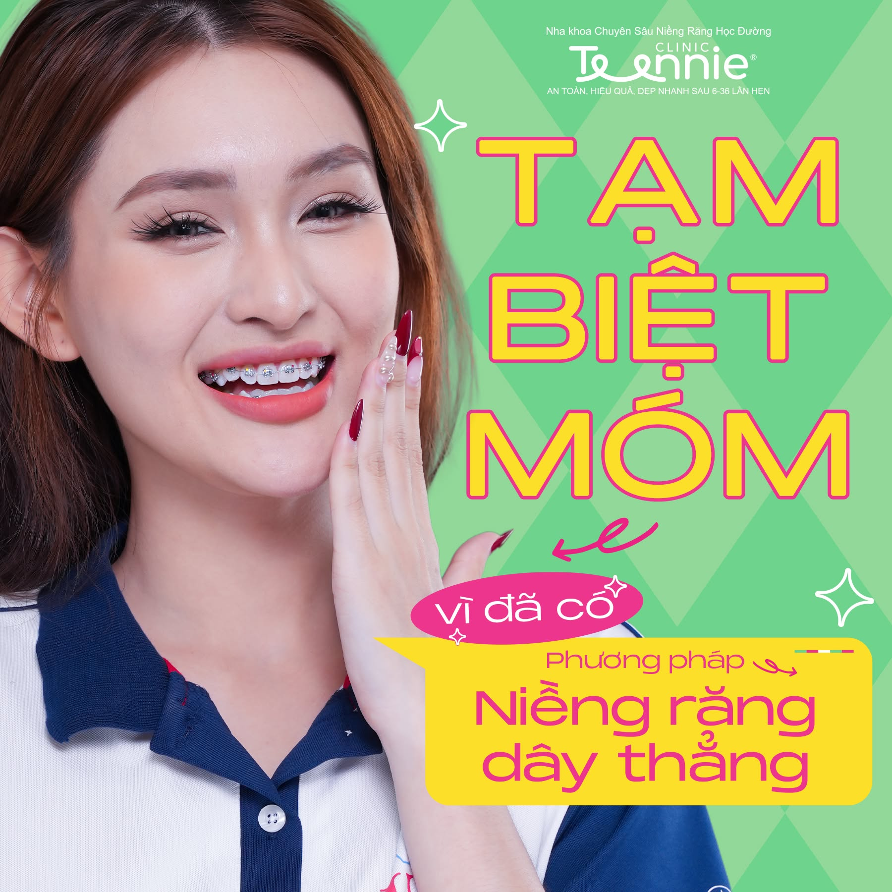 niềng dây thẳng - hình 3