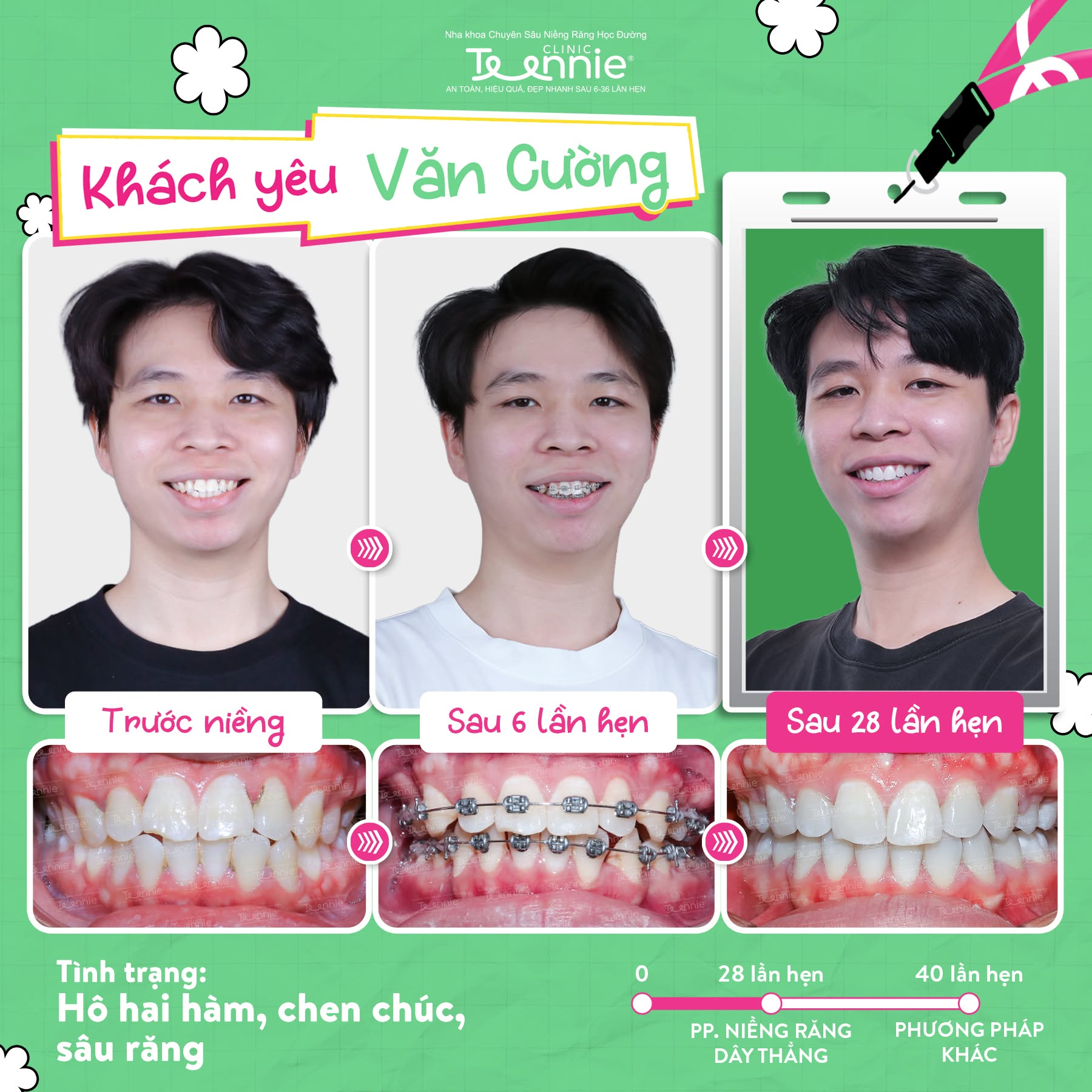 nieng kinh dien vs tu buoc 1