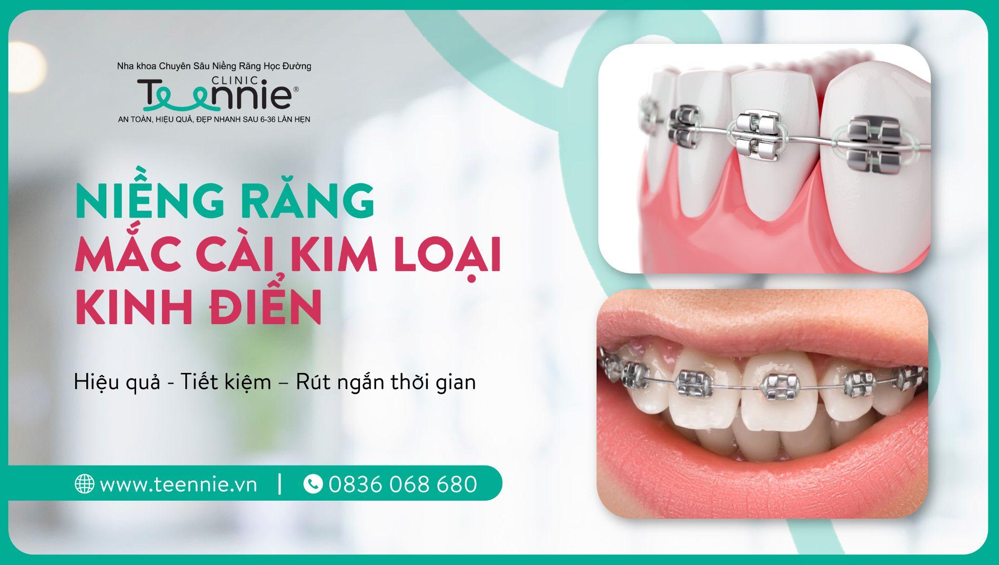 kinh điển vs tự buộc - hình 5