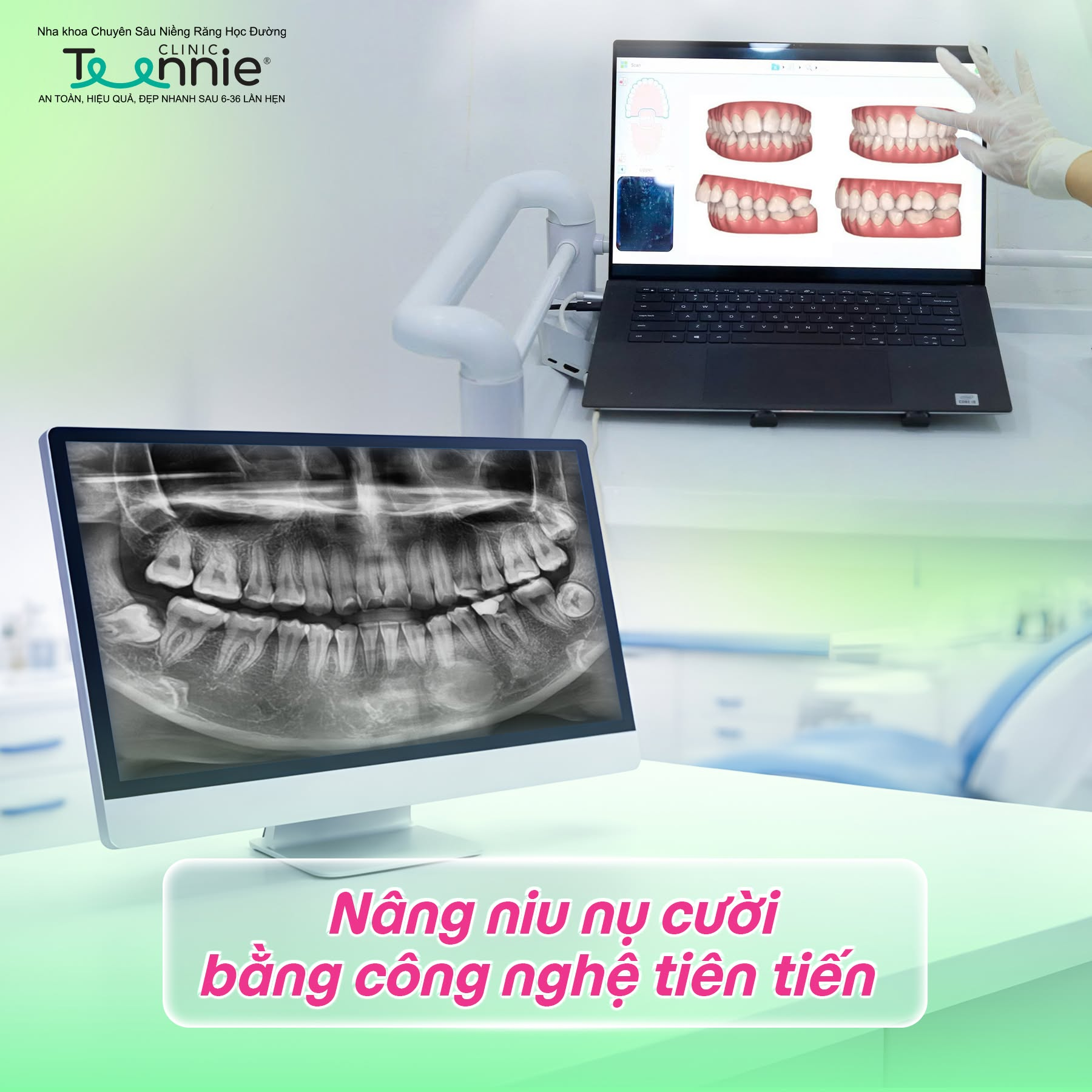 mắc cài kim loại giá - hình 3