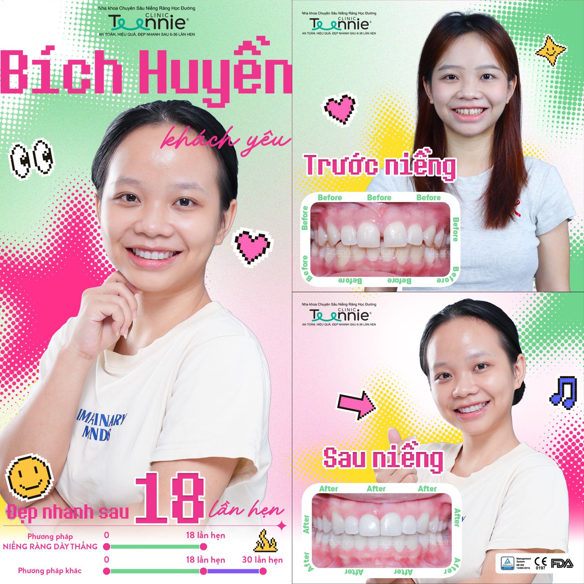 nieng rang mac cai kim loai gia 6