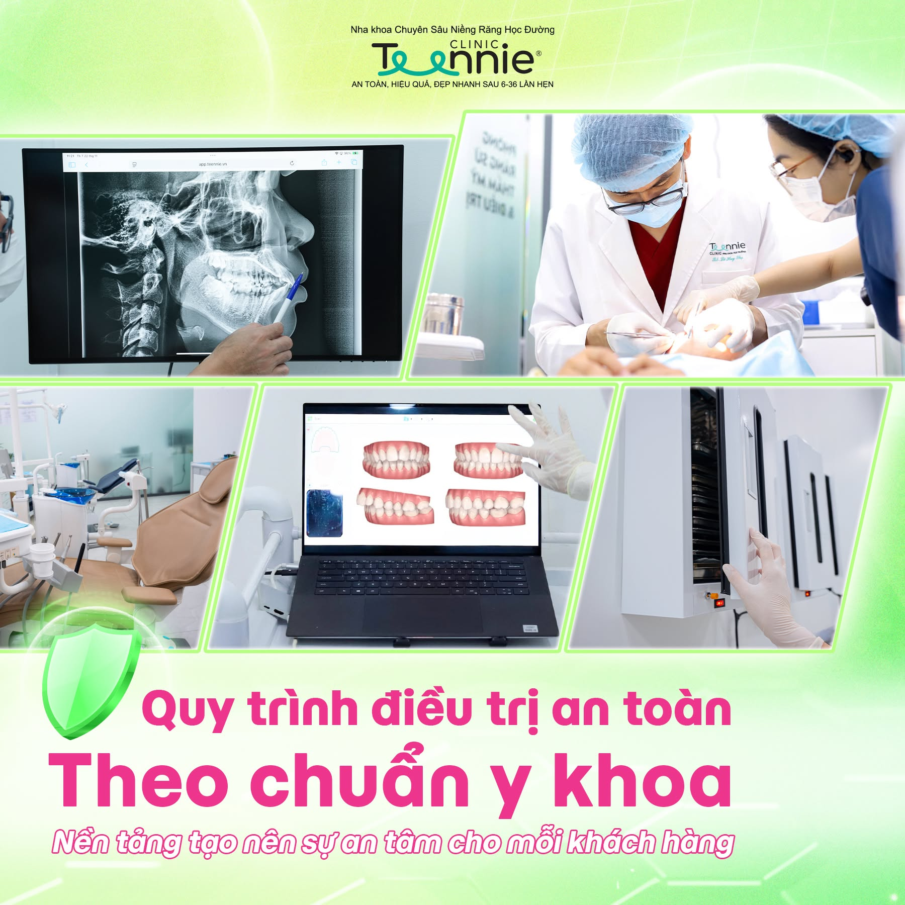 quy trinh nieng rang teennie 1