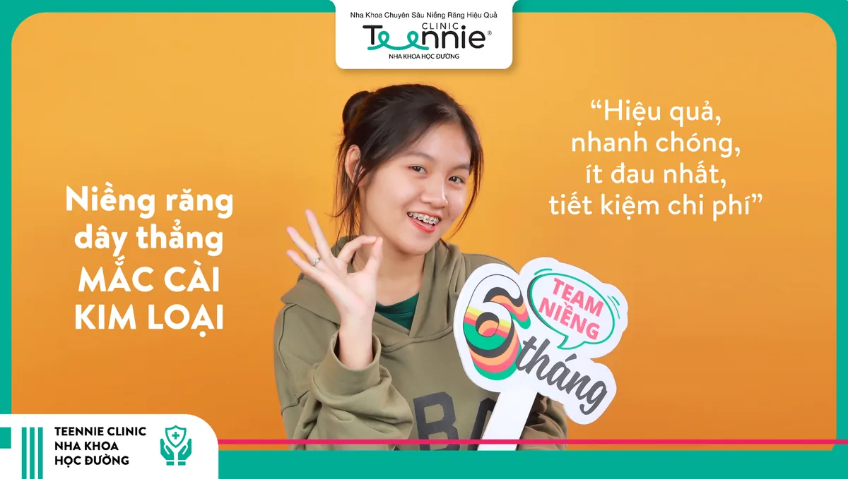 Niềng răng dây thẳng mắc cài kim loại tại Teennie Clinic - hiệu quả, nhanh chóng, ít đau, tiết kiệm chi phí