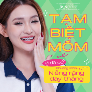Niềng răng móm: khi nào cần phẫu thuật 2026